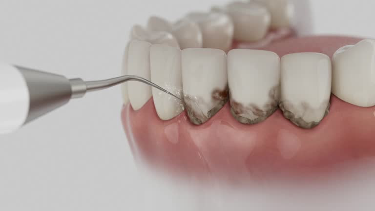 Reliable Teeth Cleaning And Checkup contractor in Clearwater County County, ID by Dentist Open Now
